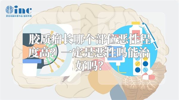 胶质瘤长哪个部位恶性程度高？一定是恶性吗能治好吗？