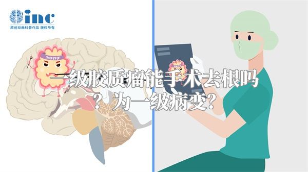 一级胶质瘤能手术去根吗？为一级病变？