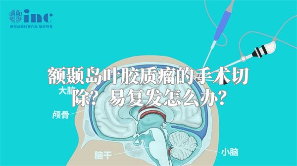 额颞岛叶胶质瘤的手术切除？易复发怎么办？