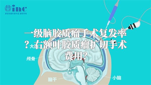 一级脑胶质瘤手术复发率？右额叶胶质瘤扩切手术费用？