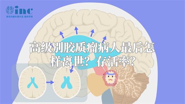 高级别胶质瘤病人最后怎样离世？存活率？