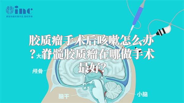 胶质瘤手术后咳嗽怎么办？脊髓胶质瘤在哪做手术最好？