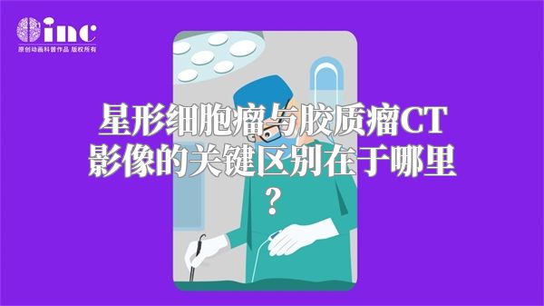 星形细胞瘤与胶质瘤CT影像的关键区别在于哪里？