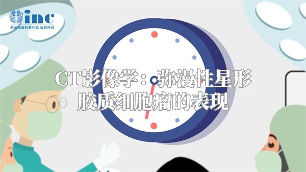 CT影像学：弥漫性星形胶质细胞瘤的表现