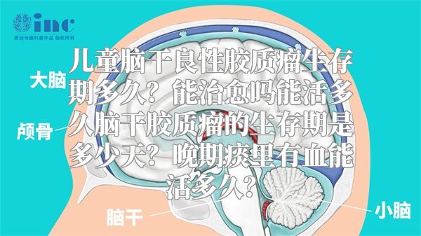 儿童脑干良性胶质瘤生存期多久？能治愈吗能活多久脑干胶质瘤的生存期是多少天？晚期痰里有血能活多久？