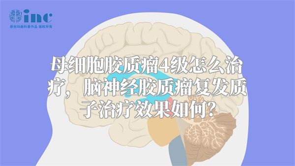 母细胞胶质瘤4级怎么治疗，脑神经胶质瘤复发质子治疗效果如何？