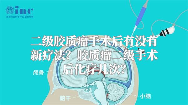 二级胶质瘤手术后有没有新疗法？胶质瘤二级手术后化疗几次？