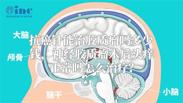 抗癌针能治胶质瘤吗多少钱，神经胶质瘤术后头痒正常吗怎么治疗？