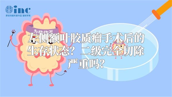 左侧额叶胶质瘤手术后的生存状态？二级完全切除严重吗？