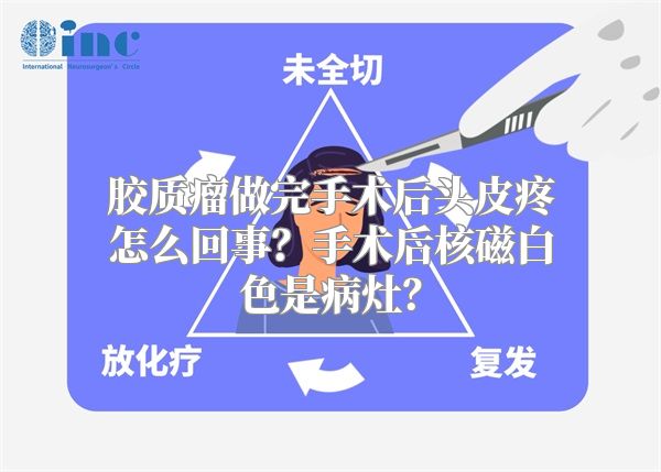 胶质瘤做完手术后头皮疼怎么回事？手术后核磁白色是病灶？