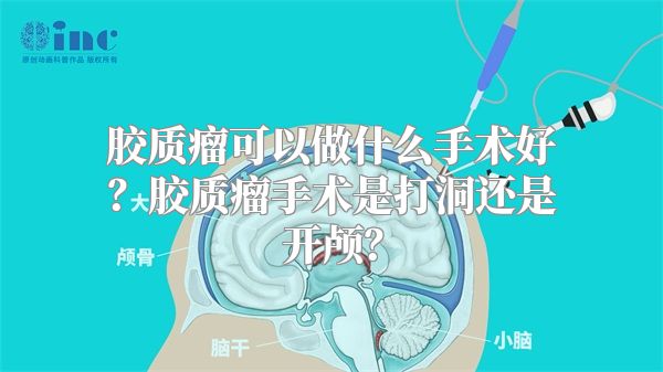 胶质瘤可以做什么手术好？胶质瘤手术是打洞还是开颅？