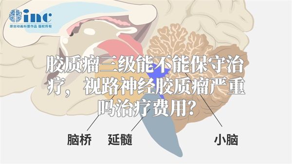 胶质瘤三级能不能保守治疗，视路神经胶质瘤严重吗治疗费用？