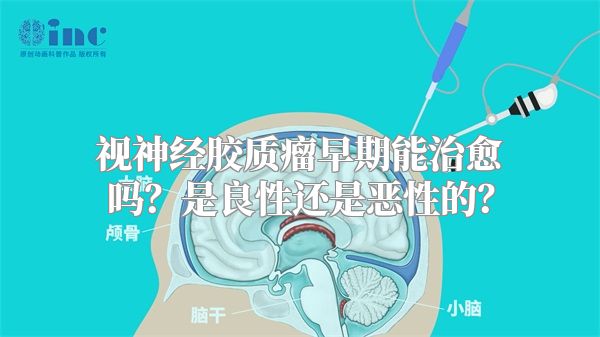 视神经胶质瘤早期能治愈吗？是良性还是恶性的？