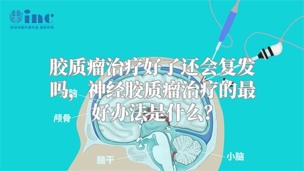 胶质瘤治疗好了还会复发吗，神经胶质瘤治疗的最好办法是什么？