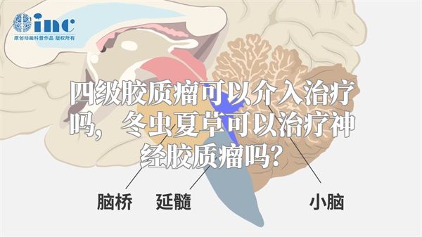 四级胶质瘤可以介入治疗吗，冬虫夏草可以治疗神经胶质瘤吗？