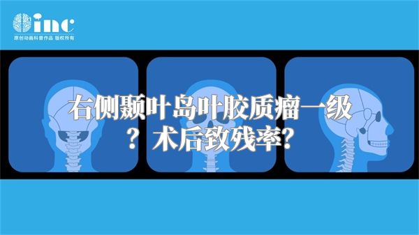 右侧颞叶岛叶胶质瘤一级？术后致残率？