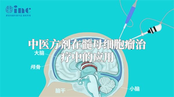 中医方剂在髓母细胞瘤治疗中的应用