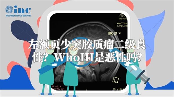 左额页少突胶质瘤二级良性？WhoIII是恶性吗？