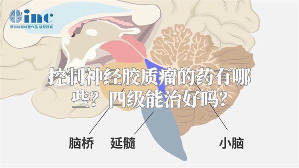 控制神经胶质瘤的药有哪些？四级能治好吗？