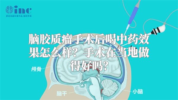 脑胶质瘤手术后喝中药效果怎么样？手术在当地做得好吗？