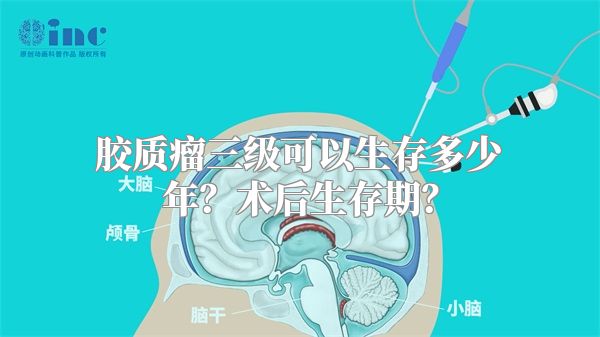 胶质瘤三级可以生存多少年？术后生存期？