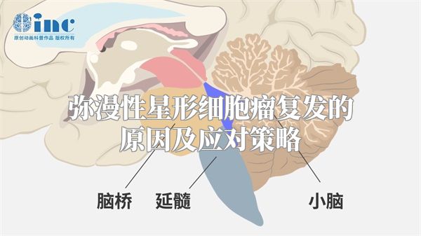 弥漫性星形细胞瘤复发的原因及应对策略