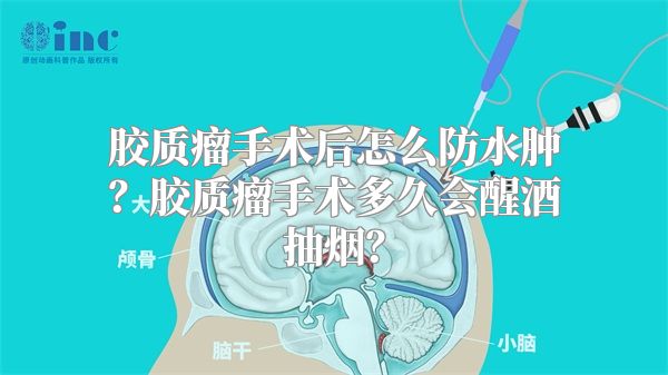 胶质瘤手术后怎么防水肿？胶质瘤手术多久会醒酒抽烟？