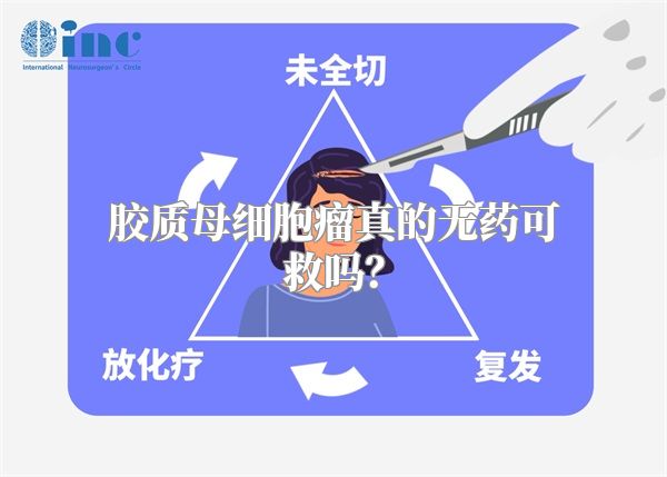 胶质母细胞瘤真的无药可救吗？