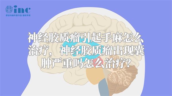 神经胶质瘤引起手麻怎么治疗，神经胶质瘤出现囊肿严重吗怎么治疗？