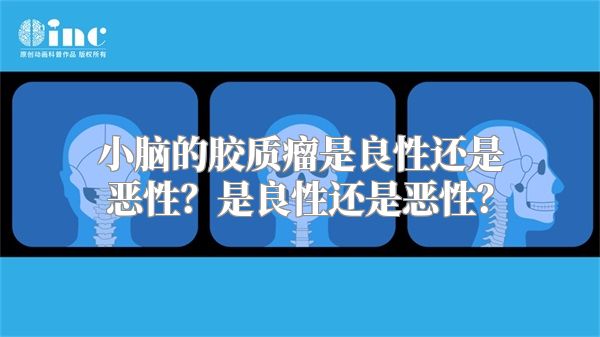 小脑的胶质瘤是良性还是恶性？是良性还是恶性？