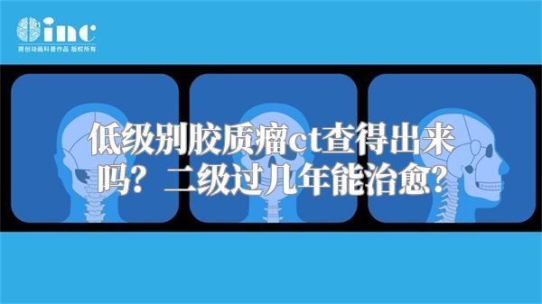 低级别胶质瘤ct查得出来吗？二级过几年能治愈？