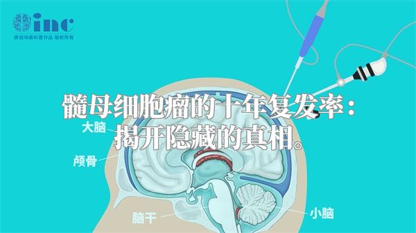 髓母细胞瘤的十年复发率：揭开隐藏的真相。