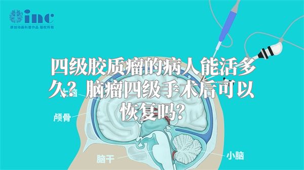 四级胶质瘤的病人能活多久？脑瘤四级手术后可以恢复吗？