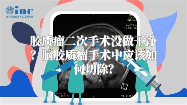 胶质瘤二次手术没做干净？脑胶质瘤手术中应该如何切除？