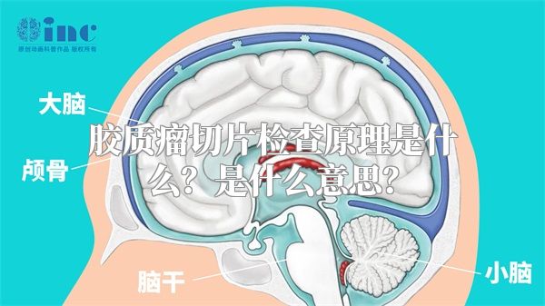 胶质瘤切片检查原理是什么？是什么意思？