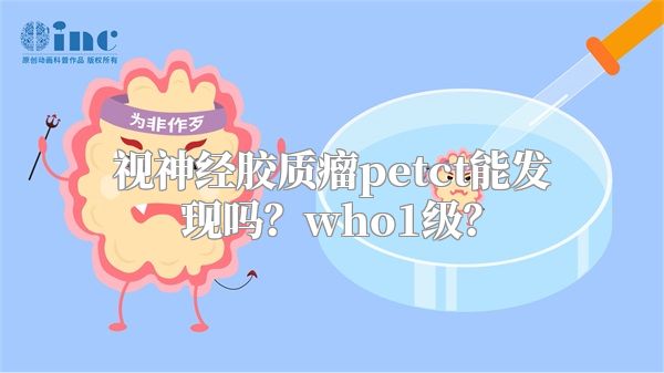 视神经胶质瘤petct能发现吗？who1级？