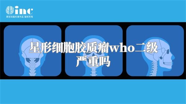 星形细胞胶质瘤who二级严重吗