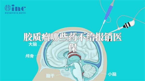 胶质瘤哪些药不给报销医保