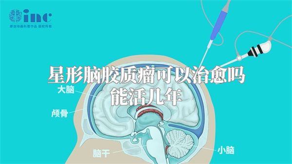 星形脑胶质瘤可以治愈吗能活几年