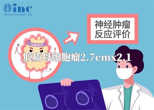 胶质母细胞瘤2.7cmx2.1