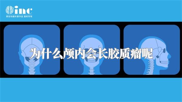 为什么颅内会长胶质瘤呢