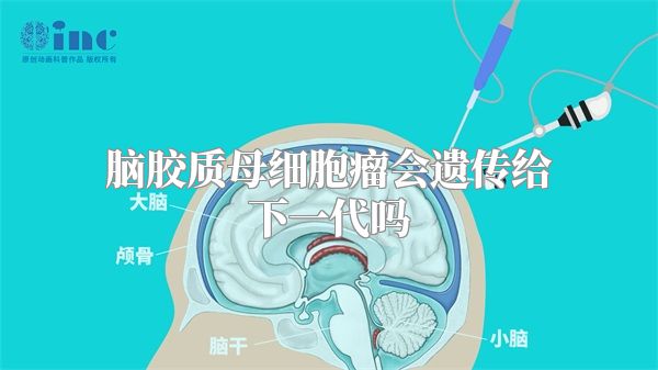 脑胶质母细胞瘤会遗传给下一代吗