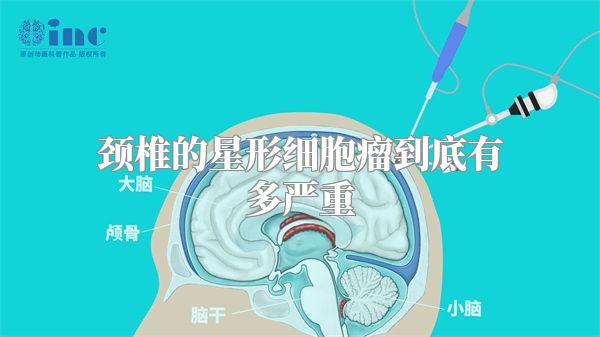 颈椎的星形细胞瘤到底有多严重