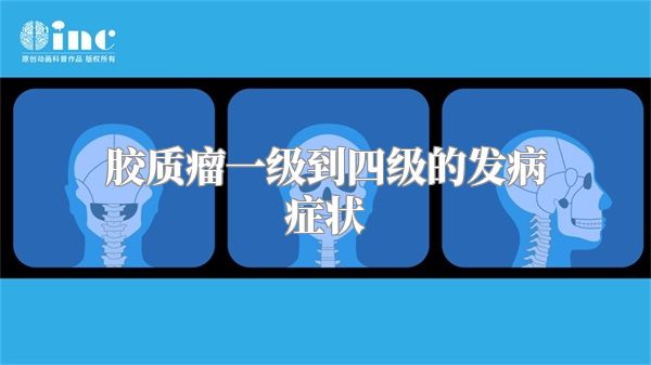 胶质瘤一级到四级的发病症状