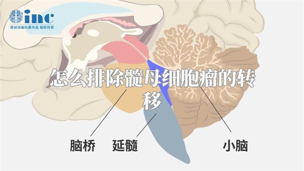 怎么排除髓母细胞瘤的转移