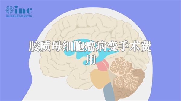 胶质母细胞瘤病变手术费用