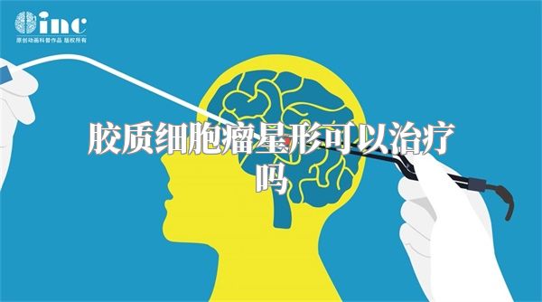 胶质细胞瘤星形可以治疗吗