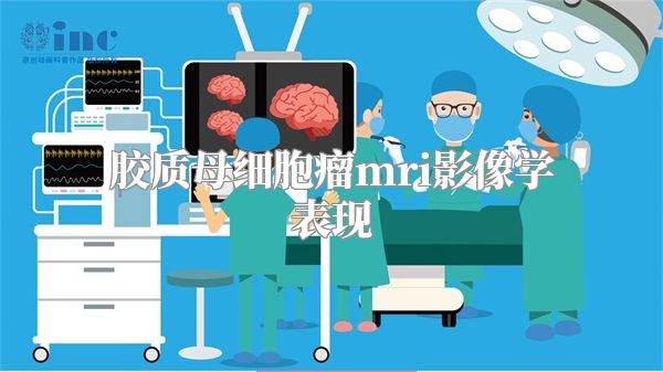 胶质母细胞瘤mri影像学表现