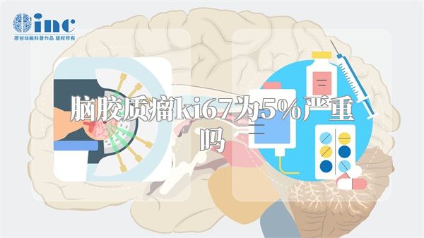 脑胶质瘤ki67为5%严重吗