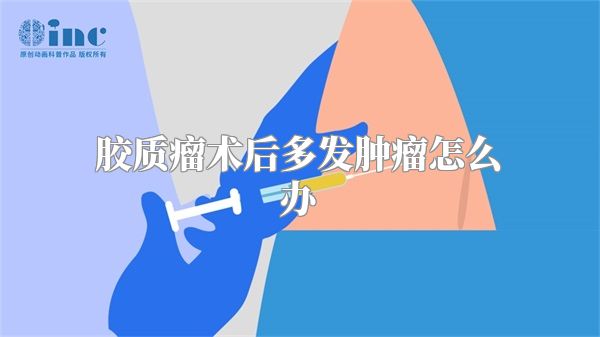 胶质瘤术后多发肿瘤怎么办